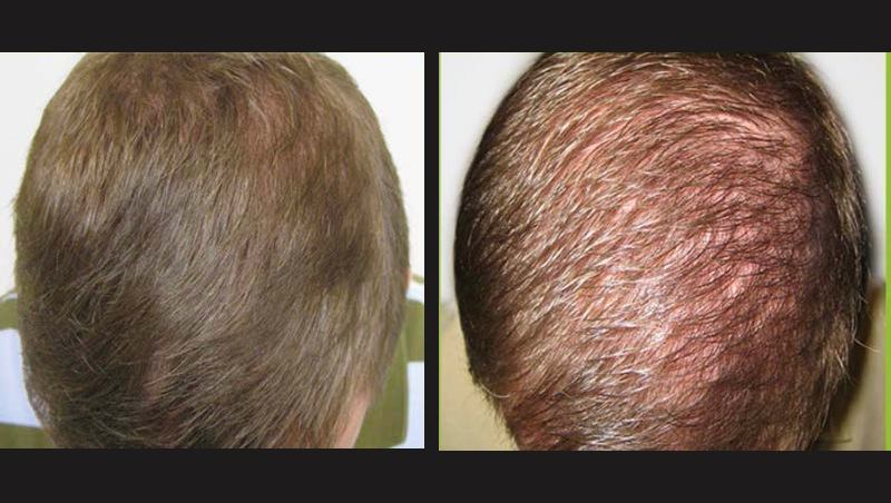 GetHairmd